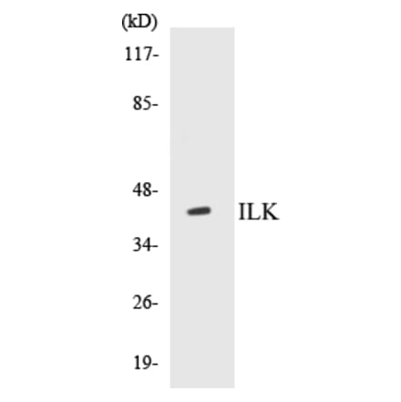 Western Blot - ILK Cell Based ELISA Kit (CB5368) - Antibodies.com