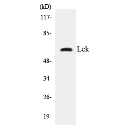 Western Blot - Lck Cell Based ELISA Kit (CB5415) - Antibodies.com