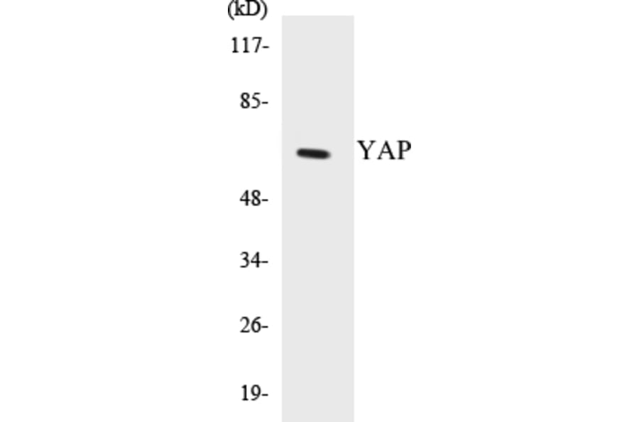Western Blot - YAP Cell Based ELISA Kit (CB5738) - Antibodies.com