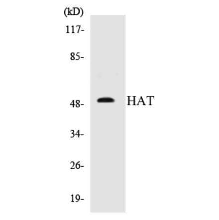Western Blot - HAT Cell Based ELISA Kit (CB5315) - Antibodies.com