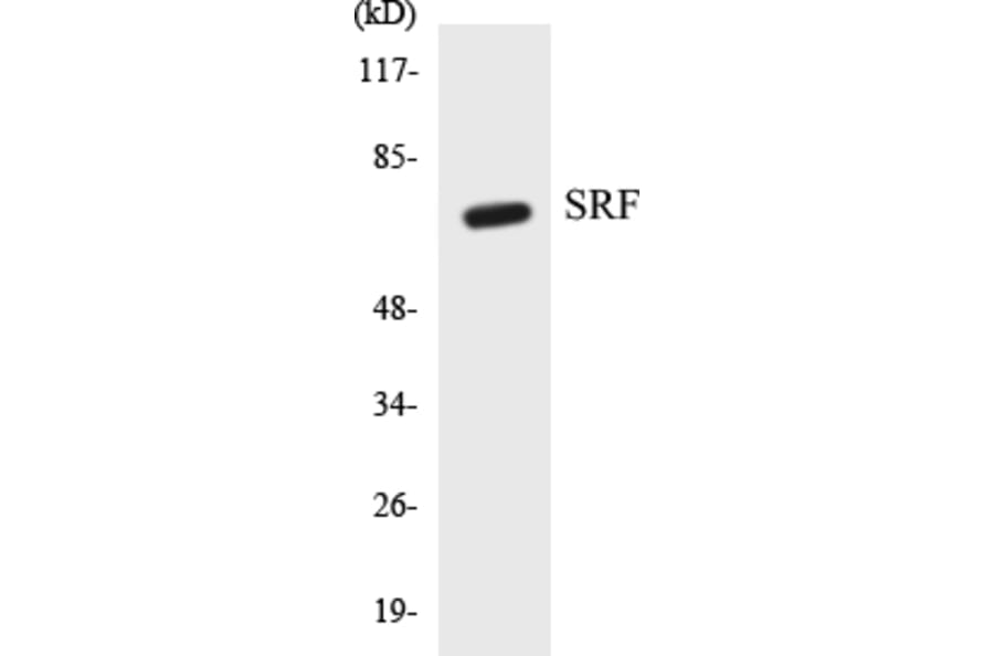 Western Blot - SRF Cell Based ELISA Kit (CB5651) - Antibodies.com