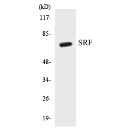 Western Blot - SRF Cell Based ELISA Kit (CB5651) - Antibodies.com