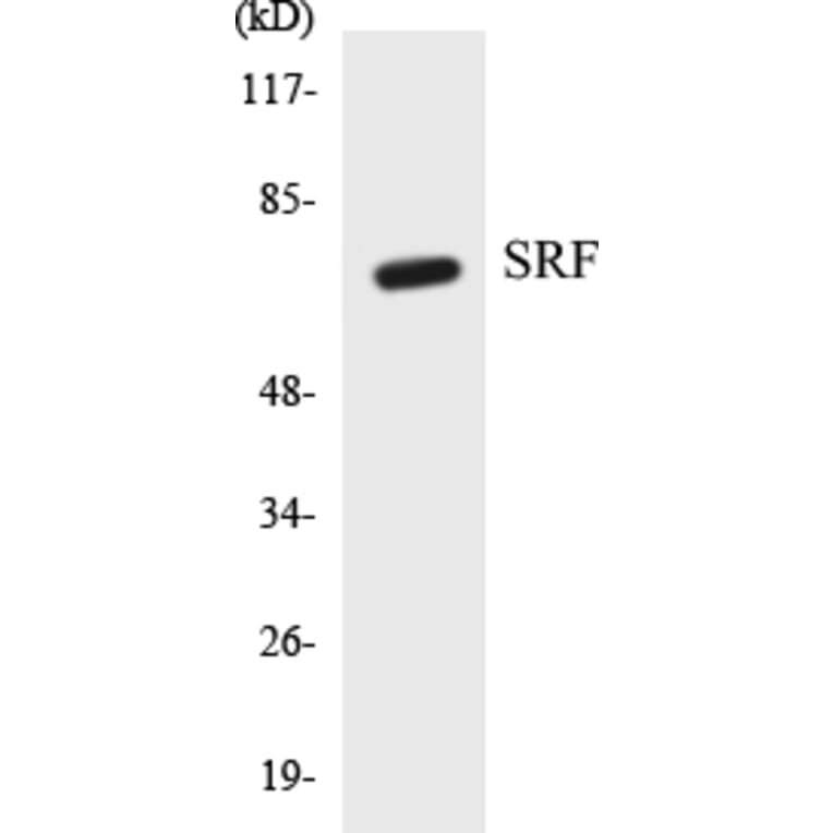 Western Blot - SRF Cell Based ELISA Kit (CB5651) - Antibodies.com