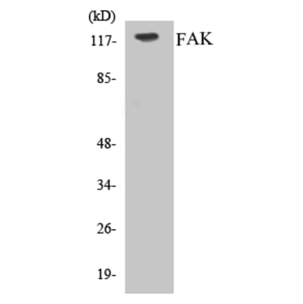 Western Blot - FAK Cell Based ELISA Kit (CB5255) - Antibodies.com