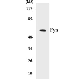 Western Blot - Fyn Cell Based ELISA Kit (CB5279) - Antibodies.com