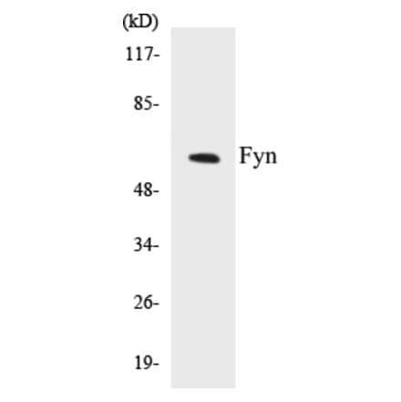 Western Blot - Fyn Cell Based ELISA Kit (CB5279) - Antibodies.com