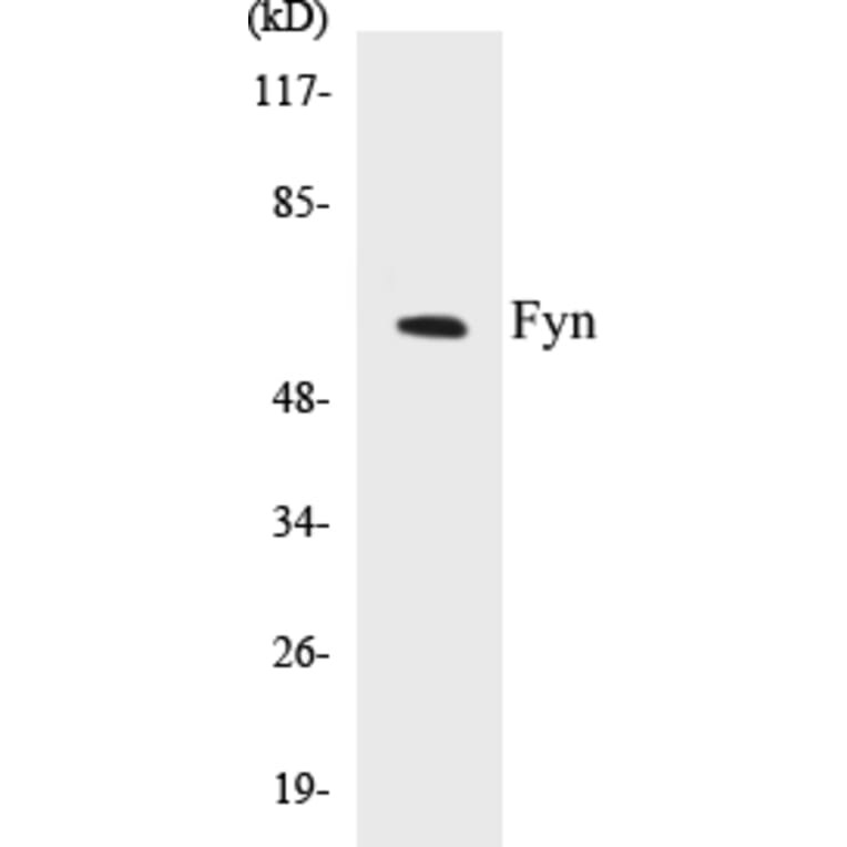 Western Blot - Fyn Cell Based ELISA Kit (CB5279) - Antibodies.com