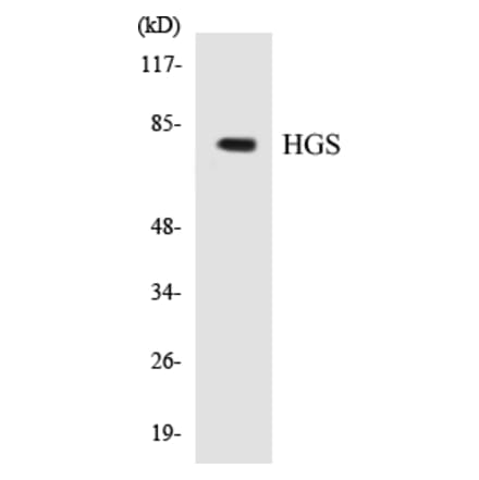 Western Blot - HGS Cell Based ELISA Kit (CB5331) - Antibodies.com