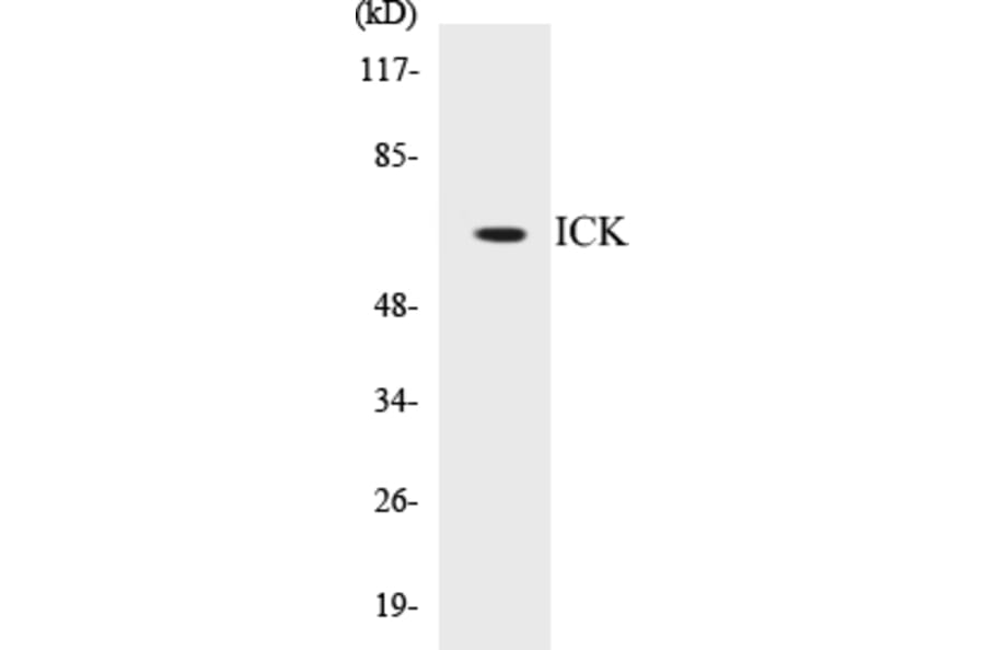 Western Blot - ICK Cell Based ELISA Kit (CB5354) - Antibodies.com