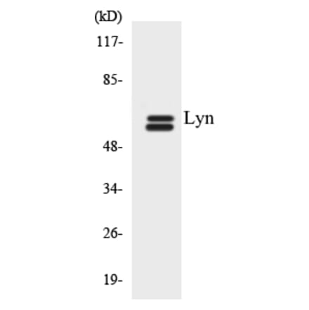 Western Blot - Lyn Cell Based ELISA Kit (CB5419) - Antibodies.com