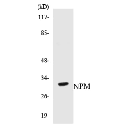 Western Blot - NPM Cell Based ELISA Kit (CB5495) - Antibodies.com