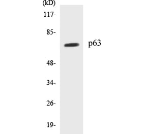 Western Blot - p63 Cell Based ELISA Kit (CB5522) - Antibodies.com