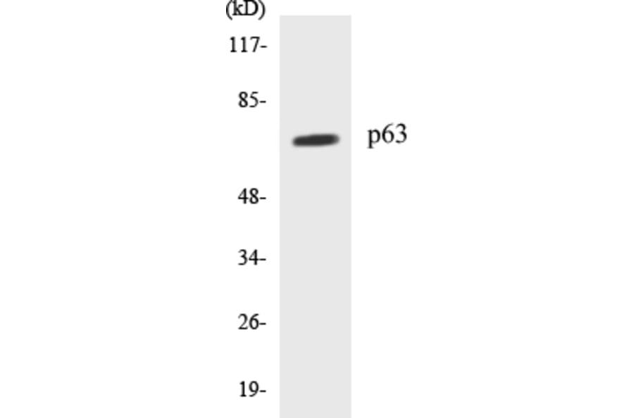 Western Blot - p63 Cell Based ELISA Kit (CB5522) - Antibodies.com