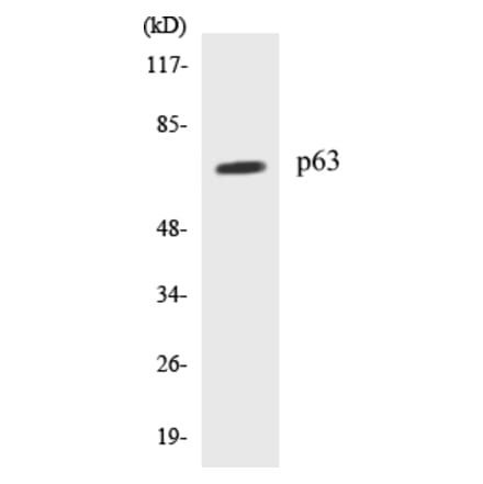 Western Blot - p63 Cell Based ELISA Kit (CB5522) - Antibodies.com