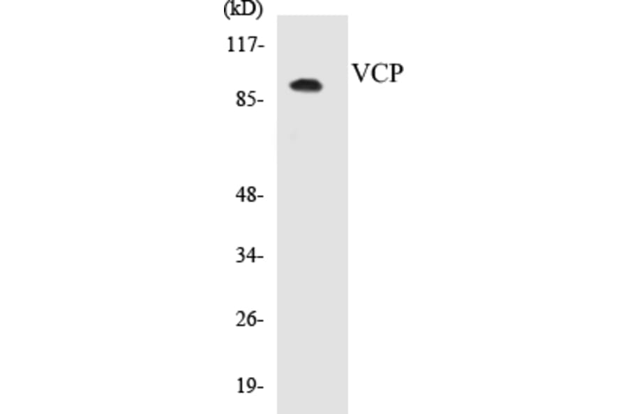 Western Blot - VCP Cell Based ELISA Kit (CB5720) - Antibodies.com