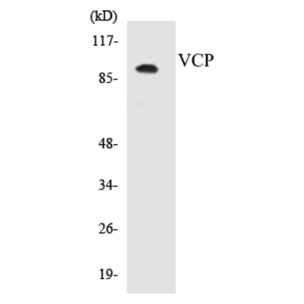 Western Blot - VCP Cell Based ELISA Kit (CB5720) - Antibodies.com
