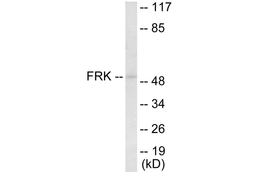 Western Blot - FRK Cell Based ELISA Kit (CB5891) - Antibodies.com