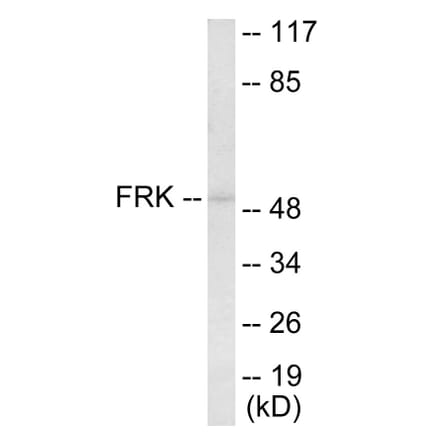 Western Blot - FRK Cell Based ELISA Kit (CB5891) - Antibodies.com