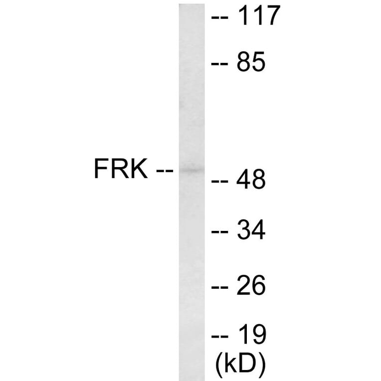 Western Blot - FRK Cell Based ELISA Kit (CB5891) - Antibodies.com