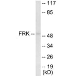 Western Blot - FRK Cell Based ELISA Kit (CB5891) - Antibodies.com