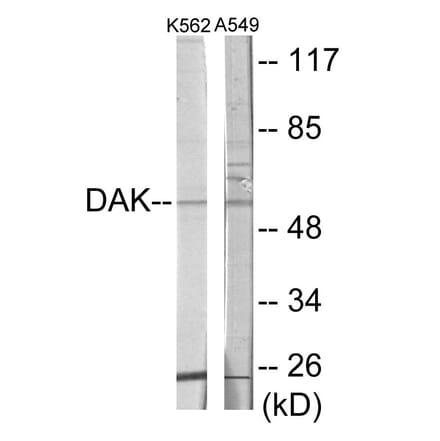 Western Blot - DAK Cell Based ELISA Kit (CB6047) - Antibodies.com