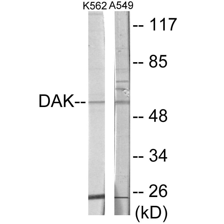 Western Blot - DAK Cell Based ELISA Kit (CB6047) - Antibodies.com