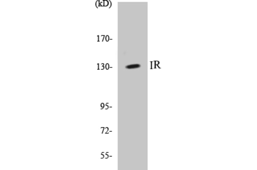 Western Blot - IR Cell Based ELISA Kit (CB5376) - Antibodies.com