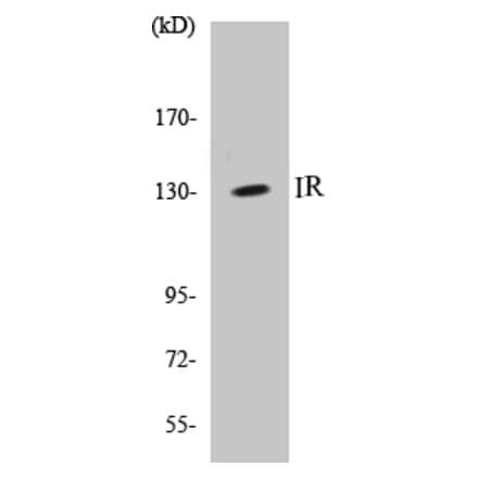 Western Blot - IR Cell Based ELISA Kit (CB5376) - Antibodies.com