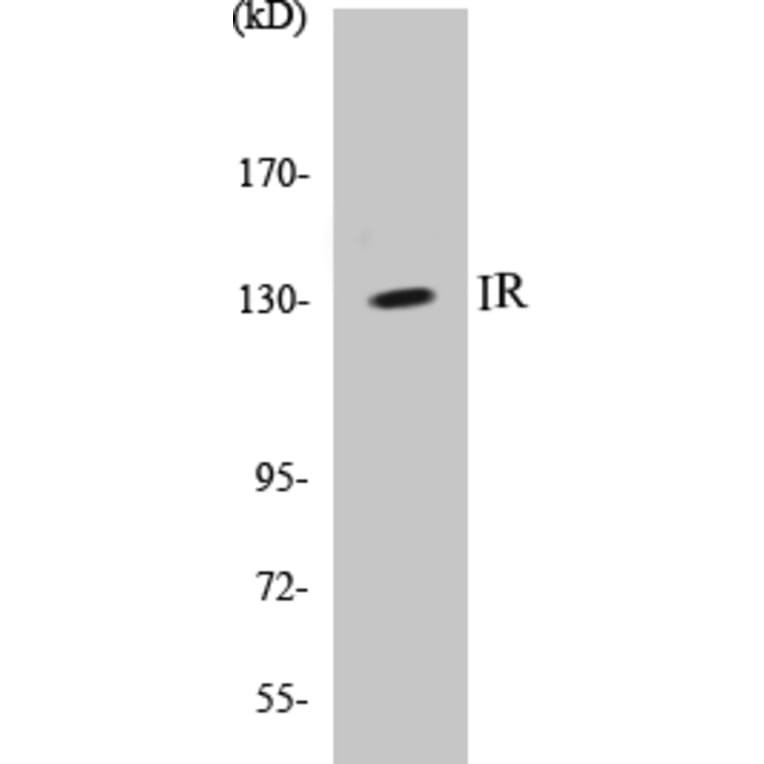 Western Blot - IR Cell Based ELISA Kit (CB5376) - Antibodies.com