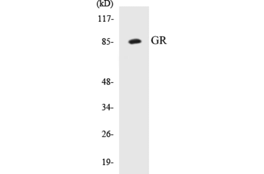 Western Blot - GR Cell Based ELISA Kit (CB5302) - Antibodies.com