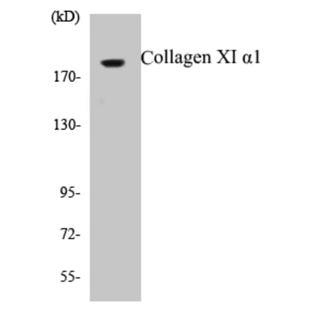 Western Blot - Collagen XI alpha 1 Cell Based ELISA Kit (CB5159) - Antibodies.com