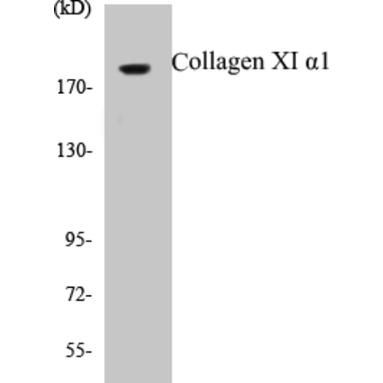 Western Blot - Collagen XI alpha 1 Cell Based ELISA Kit (CB5159) - Antibodies.com