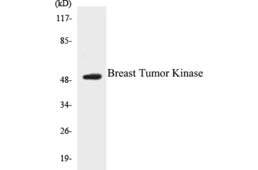 Western Blot - Breast Tumor Kinase Cell Based ELISA Kit (CB5080) - Antibodies.com