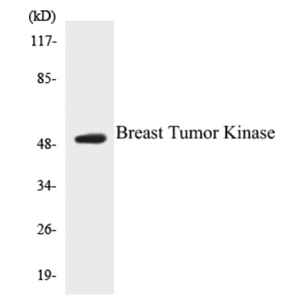 Western Blot - Breast Tumor Kinase Cell Based ELISA Kit (CB5080) - Antibodies.com