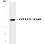 Western Blot - Breast Tumor Kinase Cell Based ELISA Kit (CB5080) - Antibodies.com