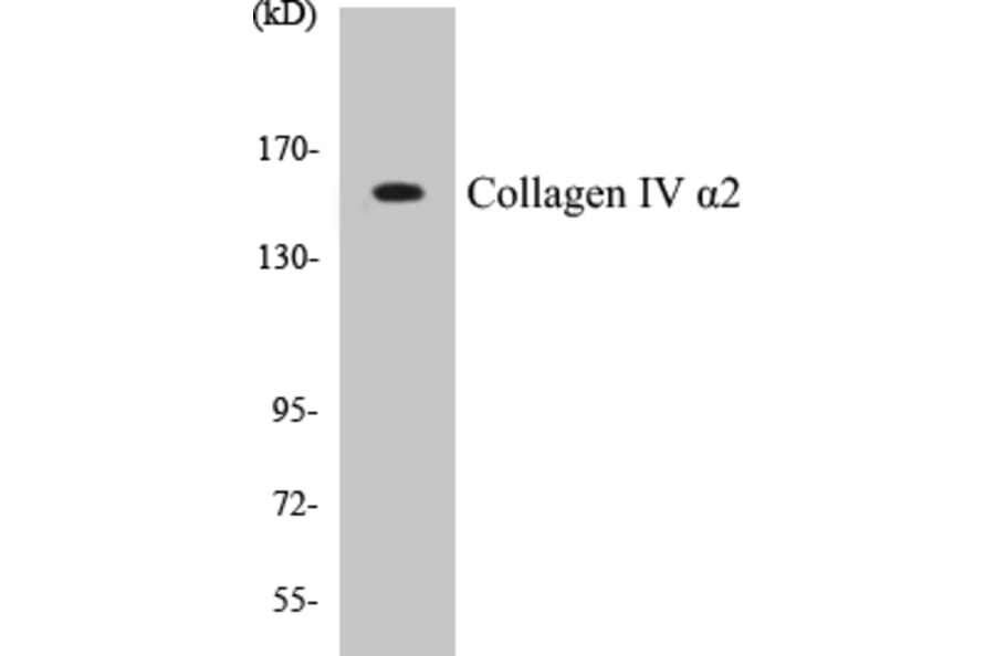 Western Blot - Collagen IV alpha 2 Cell Based ELISA Kit (CB5156) - Antibodies.com
