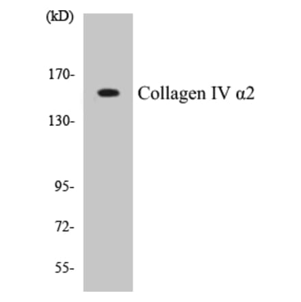 Western Blot - Collagen IV alpha 2 Cell Based ELISA Kit (CB5156) - Antibodies.com