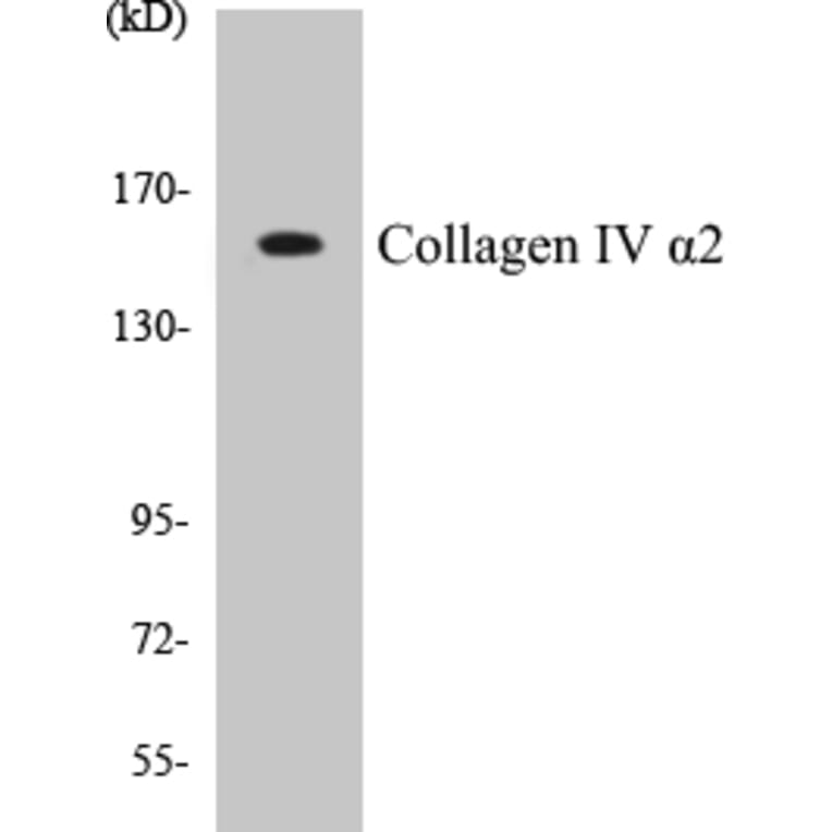 Western Blot - Collagen IV alpha 2 Cell Based ELISA Kit (CB5156) - Antibodies.com