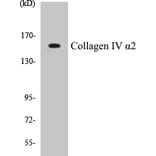 Western Blot - Collagen IV alpha 2 Cell Based ELISA Kit (CB5156) - Antibodies.com