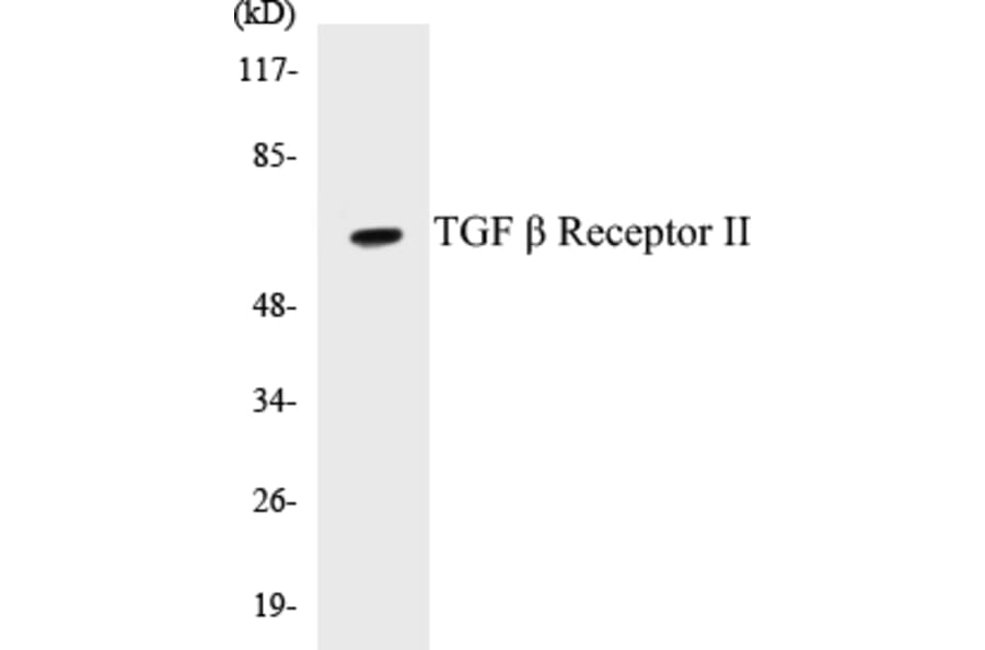 Western Blot - TGF beta ReceptorII Cell Based ELISA Kit (CB5682) - Antibodies.com