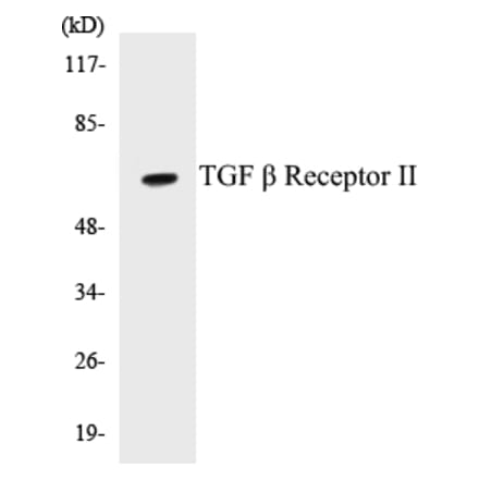 Western Blot - TGF beta ReceptorII Cell Based ELISA Kit (CB5682) - Antibodies.com