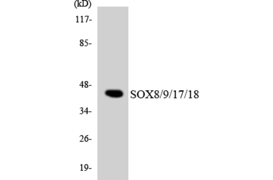 Western Blot - SOX8 + 9 + 17 + 18 Cell Based ELISA Kit (CB5931) - Antibodies.com