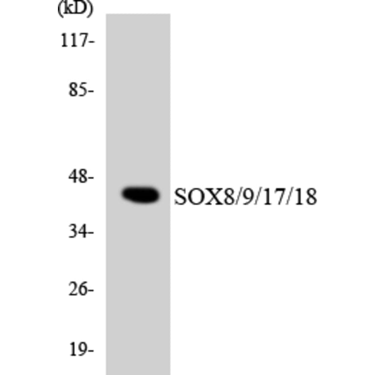 Western Blot - SOX8 + 9 + 17 + 18 Cell Based ELISA Kit (CB5931) - Antibodies.com