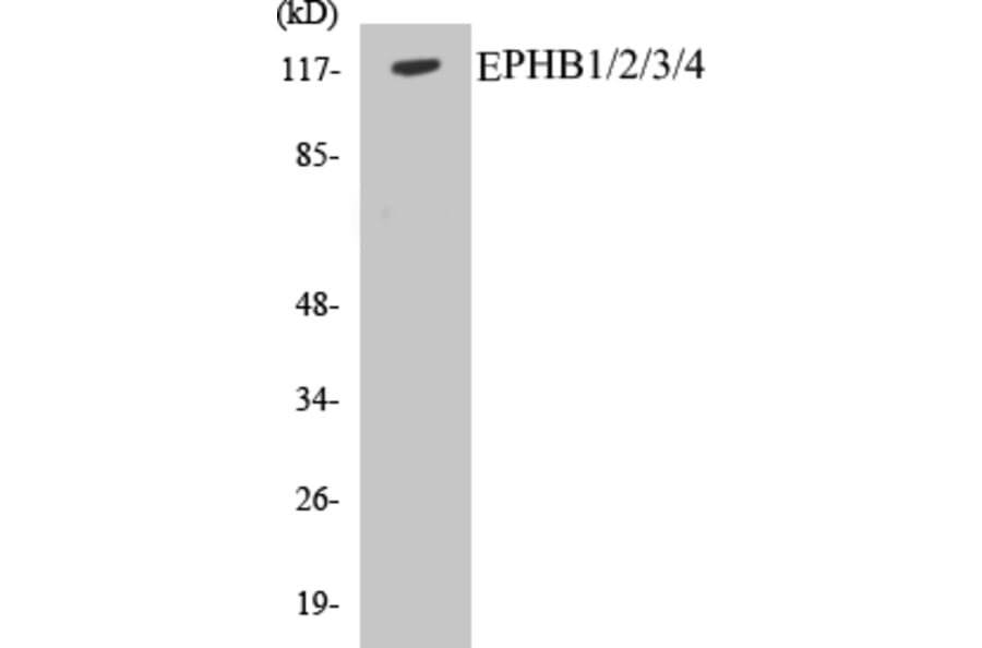 Western Blot - EPHB1 + 2 + 3 + 4 Cell Based ELISA Kit (CB5239) - Antibodies.com