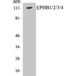 Western Blot - EPHB1 + 2 + 3 + 4 Cell Based ELISA Kit (CB5239) - Antibodies.com