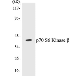 Western Blot - p70S6 Kinase beta Cell Based ELISA Kit (CB5524) - Antibodies.com