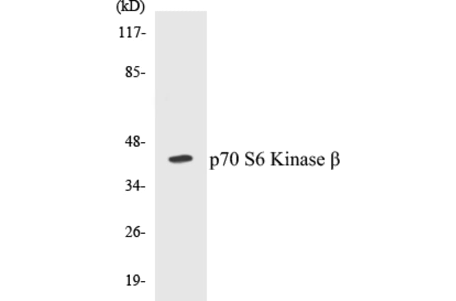 Western Blot - p70S6 Kinase beta Cell Based ELISA Kit (CB5524) - Antibodies.com