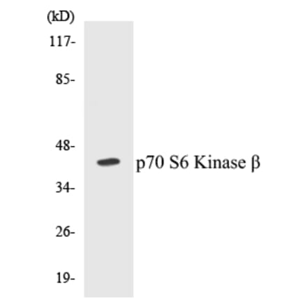 Western Blot - p70S6 Kinase beta Cell Based ELISA Kit (CB5524) - Antibodies.com