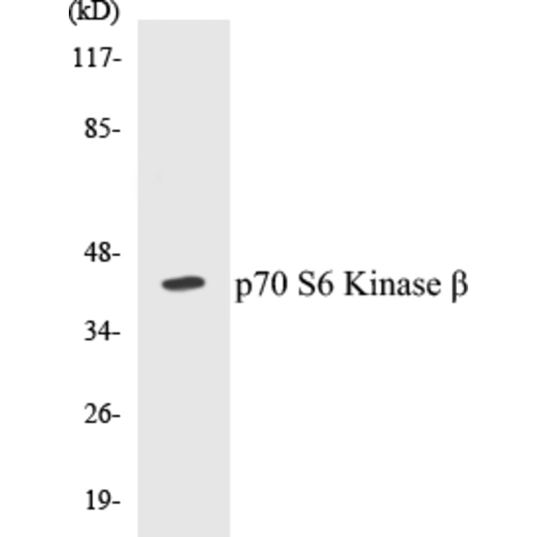 Western Blot - p70S6 Kinase beta Cell Based ELISA Kit (CB5524) - Antibodies.com
