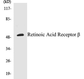 Western Blot - Retinoic Acid Receptor beta Cell Based ELISA Kit (CB5608) - Antibodies.com